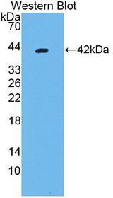 VCC-1 / CXCL17 Antibody - Western blot of VCC-1 / CXCL17 antibody.