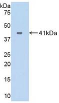 VCC-1 / CXCL17 Antibody - Western Blot; Sample: Recombinant VCC1, Human.