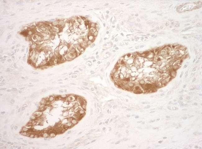 VCL / Vinculin Antibody - Detection of Human Vinculin by Immunohistochemistry. Sample: FFPE section of human testis. Antibody: Affinity purified rabbit anti-Vinculin used at a dilution of 1:250.