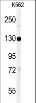 VCL / Vinculin Antibody - Western blot of anti-VINC Antibody in K562 cell line lysates (35 ug/lane). VINC (arrow) was detected using the purified antibody.