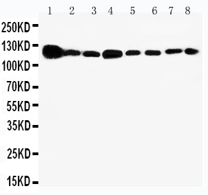 VCL / Vinculin Antibody - WB of VCL / Vinculin antibody. All lanes: Anti-VCL at 0.5ug/ml. Lane 1: Rat Heart Tissue Lysate at 40ug. Lane 2: Rat Brain Tissue Lysate at 40ug. Lane 3: Rat Liver Tissue Lysate at 40ug. Lane 4: U87 Whole Cell Lysate at 40ug. Lane 5: SMMC Whole Cell Lysate at 40ug. Lane 6: HEPA Whole Cell Lysate at 40ug. Lane 7: HELA Whole Cell Lysate at 40ug. Lane 8: HT1080 Whole Cell Lysate at 40ug. Predicted bind size: 124KD. Observed bind size: 124KD.