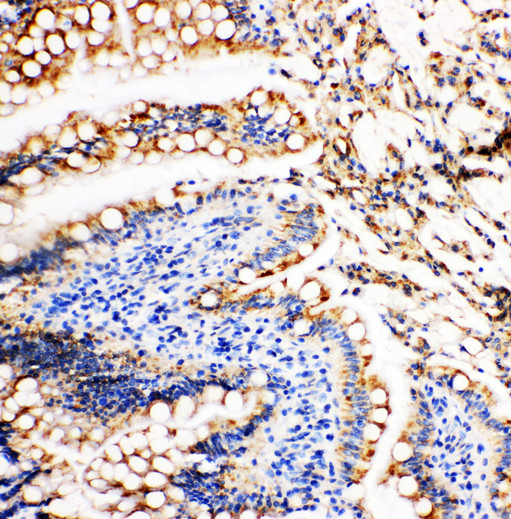 VCL / Vinculin Antibody - VCL / Vinculin antibody. IHC(P): Rat Intestine Tissue.