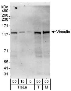 VCL / Vinculin Antibody - Detection of Human and Mouse Vinculin by Western Blot. Samples: Whole cell lysate from HeLa (5, 15 and 50 ug), 293T (T; 50 ug), and mouse NIH3T3 (M; 50 ug) cells. Antibodies: Affinity purified rabbit anti-Vinculin antibody used for WB at 0.1 ug/ml. Detection: Chemiluminescence with an exposure time of 3 minutes.