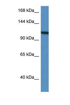 VCL / Vinculin Antibody - VCL / Vinculin antibody Western blot of HepG2 Cell lysate. Antibody concentration 1 ug/ml.  This image was taken for the unconjugated form of this product. Other forms have not been tested.