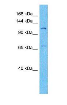 VCL / Vinculin Antibody - Western blot of VINC Antibody with human PANC1 Whole Cell lysate.  This image was taken for the unconjugated form of this product. Other forms have not been tested.