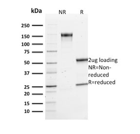 VCL / Vinculin Antibody - SDS-PAGE analysis of purified, BSA-free Vinculin antibody (clone VCL/2573) as confirmation of integrity and purity.