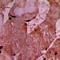 VCL / Vinculin Antibody - Immunohistochemical analysis of Vinculin staining in human heart formalin fixed paraffin embedded tissue section. The section was pre-treated using heat mediated antigen retrieval with sodium citrate buffer (pH 6.0). The section was then incubated with the antibody at room temperature and detected using an HRP-conjugated compact polymer system. DAB was used as the chromogen. The section was then counterstained with hematoxylin and mounted with DPX.