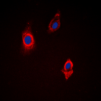 VCL / Vinculin Antibody - Immunofluorescent analysis of Vinculin staining in HepG2 cells. Formalin-fixed cells were permeabilized with 0.1% Triton X-100 in TBS for 5-10 minutes and blocked with 3% BSA-PBS for 30 minutes at room temperature. Cells were probed with the primary antibody in 3% BSA-PBS and incubated overnight at 4 deg C in a humidified chamber. Cells were washed with PBST and incubated with a DyLight 594-conjugated secondary antibody (red) in PBS at room temperature in the dark. DAPI was used to stain the cell nuclei (blue).