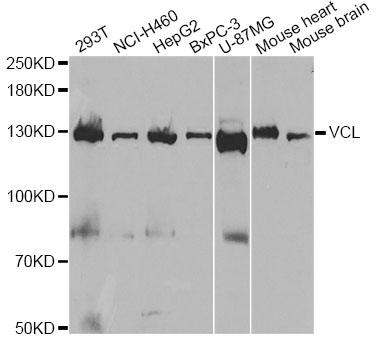 VCL / Vinculin Antibody - Western blot analysis of extracts of various cell lines, using VCL antibody at 1:1000 dilution. The secondary antibody used was an HRP Goat Anti-Rabbit IgG (H+L) at 1:10000 dilution. Lysates were loaded 25ug per lane and 3% nonfat dry milk in TBST was used for blocking. An ECL Kit was used for detection and the exposure time was 40s.