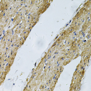 VCL / Vinculin Antibody - Immunohistochemistry of paraffin-embedded human smooth muscle using VCL Antibodyat dilution of 1:100 (40x lens).