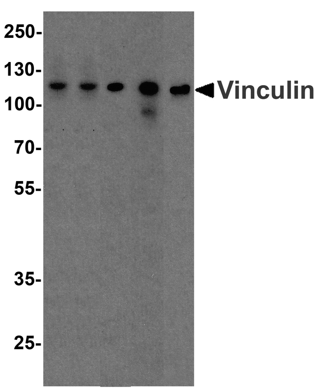 VCL / Vinculin Antibody - Western blot analysis of Vinculin in A431, Daudi, Jurkat, Raji, and THP-1 cell lysate with Vinculin antibody at 1 ug/ml.