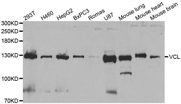 VCL / Vinculin Antibody - Western blot analysis of extracts of various cell lines, using VCL antibody at 1:1000 dilution. The secondary antibody used was an HRP Goat Anti-Rabbit IgG (H+L) at 1:10000 dilution. Lysates were loaded 25ug per lane and 3% nonfat dry milk in TBST was used for blocking.