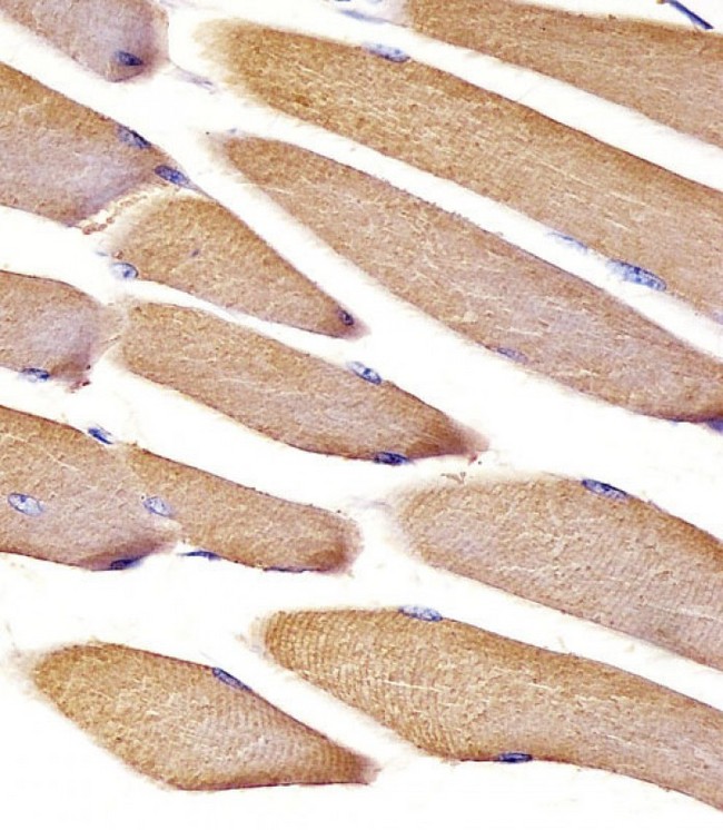 VCL / Vinculin Antibody - Vinculin Antibody staining Vinculin in mouse skeletal muscle tissue sections by Immunohistochemistry (IHC-P - paraformaldehyde-fixed, paraffin-embedded sections). Tissue was fixed with formaldehyde and blocked with 3% BSA for 0. 5 hour at room temperature; antigen retrieval was by heat mediation with a citrate buffer (pH6). Samples were incubated with primary antibody (1/25) for 1 hours at 37°C. A undiluted biotinylated goat polyvalent antibody was used as the secondary antibody.