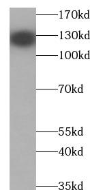 VCL / Vinculin Antibody - Hela lysates were subjected to SDS PAGE followed by western blot with (Vinculin antibody at dilution of 1:5000
