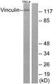VCL / Vinculin Antibody - Western blot analysis of extracts from HeLa cells, treated with forskolin (40nM, 30mins), using Vinculin (Ab-821) antibody.