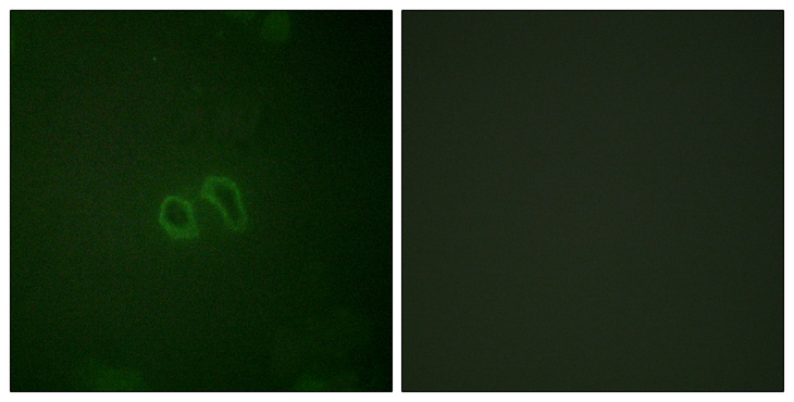 VCL / Vinculin Antibody - Immunofluorescence analysis of HepG2 cells, using Vinculin (Phospho-Tyr821) Antibody. The picture on the right is blocked with the phospho peptide.