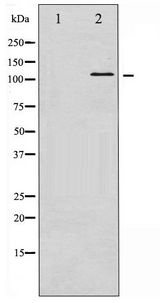 VCL / Vinculin Antibody - Western blot of Vinculin phosphorylation expression in forskolin treated HeLa whole cell lysates,The lane on the left is treated with the antigen-specific peptide.