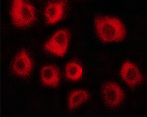VCL / Vinculin Antibody - Staining HepG2 cells by IF/ICC. The samples were fixed with PFA and permeabilized in 0.1% saponin prior to blocking in 10% serum for 45 min at 37°C. The primary antibody was diluted 1/400 and incubated with the sample for 1 hour at 37°C. A Alexa Fluor 594 conjugated goat polyclonal to rabbit IgG (H+L), diluted 1/600 was used as secondary antibody.