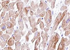 VCL / Vinculin Antibody - 1:100 staining human heart muscle tissue by IHC-P. The tissue was formaldehyde fixed and a heat mediated antigen retrieval step in citrate buffer was performed. The tissue was then blocked and incubated with the antibody for 1.5 hours at 22°C. An HRP conjugated goat anti-rabbit antibody was used as the secondary.
