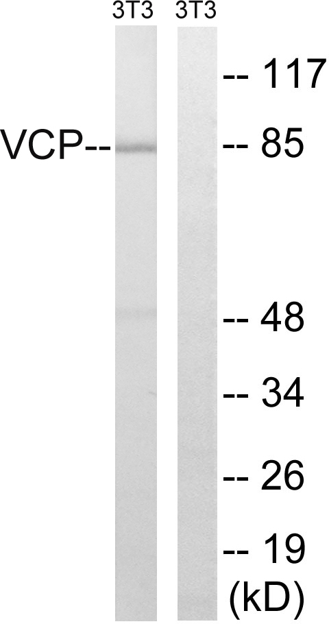 VCP Antibody - Western blot analysis of lysates from NIH/3T3 cells, treated with starved 24h, using VCP Antibody. The lane on the right is blocked with the synthesized peptide.