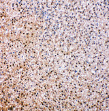 VCP Antibody - VCP antibody. IHC(P): Rat Epinephros Tissue.