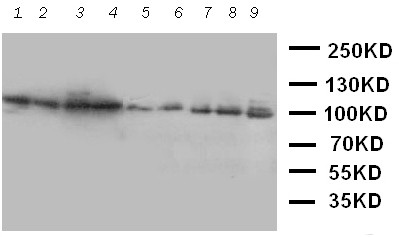 VCP Antibody - WB of VCP antibody. Lane 1: Rat Brain Tissue Lysate. Lane 2: Rat Kidney Tissue Lysate. Lane 3: Rat Liver Tissue Lysate. Lane 4: Rat Lung Tissue Lysate. Lane 5: HELA Cell Lysate. Lane 6: HL-60 Cell Lysate. Lane 7: A431 Cell Lysate. Lane 8: A549 Cell Lysate. Lane 9: SMMC Cell Lysate.
