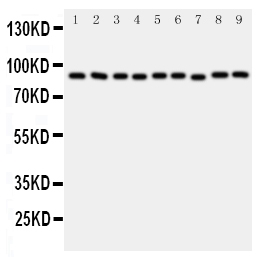 VCP Antibody - Anti-VCP antibody, Western blotting All lanes: Anti VCP (PA 2137) at 0.5ug/ml Lane 1: Rat Brain Tissue Lysate at 50ugLane 2: Rat Kidney Tissue Lysate at 50ugLane 3: Rat Liver Tissue Lysate at 50ugLane 4: Rat Lung Tissue Lysate at 50ugLane 5: HELA Whole Cell Lysate at 40ugLane 6: HL-60 Whole Cell Lysate at 40ugLane 7: A431 Whole Cell Lysate at 40ugLane 8: A549 Whole Cell Lysate at 40ugLane 9: SMMC Whole Cell Lysate at 40ugPredicted bind size: 89KD Observed bind size: 89KD