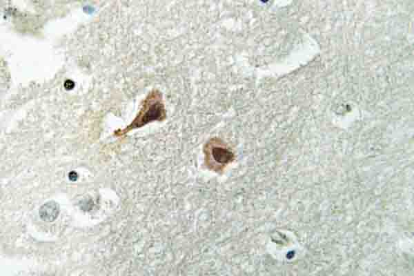 VCP Antibody - IHC of VCP (A346) pAb in paraffin-embedded human brain tissue.