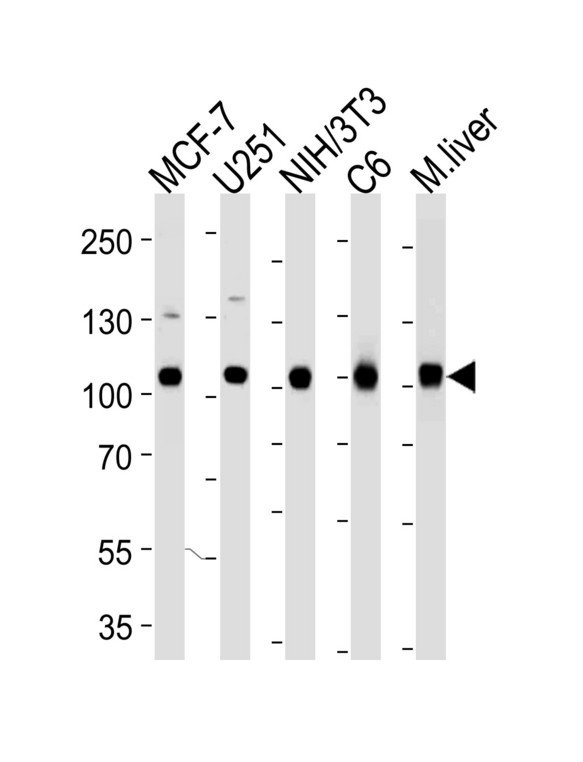 VCP Antibody - Western blot of lysates from MCF-7, U251, mouse NIH/3T3, rat C6 cell line and mouse liver tissue lysate (from left to right) using VCP Antibody. Antibody was diluted at 1:1000 at each lane. A goat anti-mouse IgG H&L (HRP) at 1:3000 dilution was used as the secondary antibody. Lysates at 35 ug per lane.