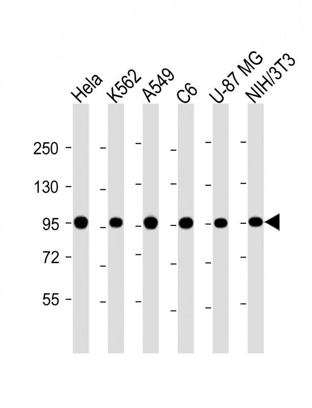 VCP Antibody - All lanes : Anti-VCP Antibody at 1:4000 dilution Lane 1: Hela whole cell lysate Lane 2: K562 whole cell lysate Lane 3: A549 whole cell lysate Lane 4: C6 whole cell lysate Lane 5: U-87 MG whole cell lysate Lane 6: NIH/3T3 whole cell lysate Lysates/proteins at 20 µg per lane. Secondary Goat Anti-mouse IgG, (H+L), Peroxidase conjugated at 1/10000 dilution. Predicted band size : 89 kDa Blocking/Dilution buffer: 5% NFDM/TBST.