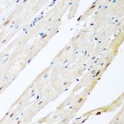 VCP Antibody - Immunohistochemistry of paraffin-embedded rat heart using VCP antibody at dilution of 1:200 (40x lens).