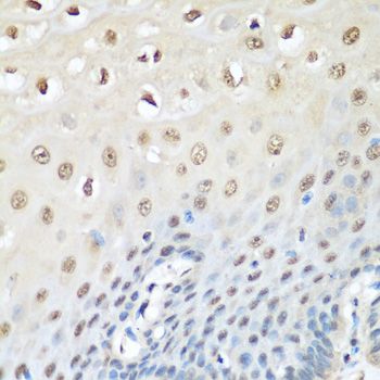 VCP Antibody - Immunohistochemistry of paraffin-embedded human esophagus using VCP antibody at dilution of 1:200 (40x lens).