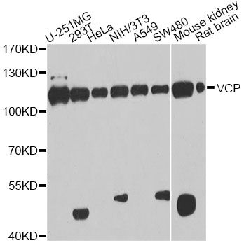 VCP Antibody - Western blot analysis of extracts of various cell lines, using VCP antibody at 1:1000 dilution. The secondary antibody used was an HRP Goat Anti-Rabbit IgG (H+L) at 1:10000 dilution. Lysates were loaded 25ug per lane and 3% nonfat dry milk in TBST was used for blocking. An ECL Kit was used for detection and the exposure time was 30s.