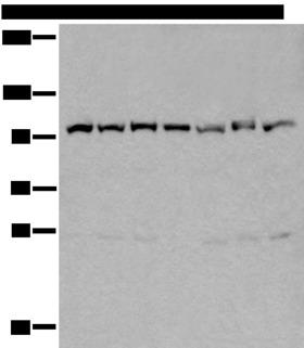 VCP Antibody - Western blot analysis of 231 Hela A549 A431 HEPG2 Jurkat and K562 cell lysates  using VCP Polyclonal Antibody at dilution of 1:400