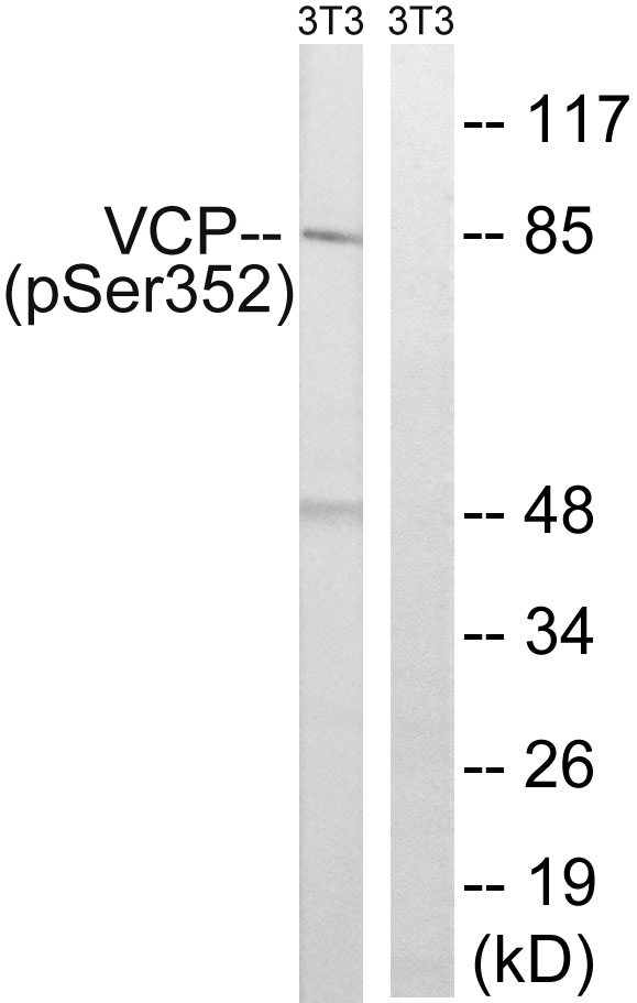 VCP Antibody - Western blot analysis of lysates from NIH/3T3 cells treated with starved 24h, using VCP (Phospho-Ser352) Antibody. The lane on the right is blocked with the phospho peptide.