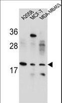 VCX Antibody - VCX1/VCX2/VCX3 Antibody western blot of A2058,MCF-7,MDA-MB453 cell line lysates (35 ug/lane). The VCX1/VCX2/VCX3 antibody detected the VCX1/VCX2/VCX3 protein (arrow).