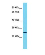 VCX3A Antibody - Western blot of VCX3A Antibody - N-terminal region with human ACHN cells lysate.  This image was taken for the unconjugated form of this product. Other forms have not been tested.