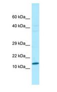 VCY Antibody - VCY antibody Western Blot of HeLa.  This image was taken for the unconjugated form of this product. Other forms have not been tested.