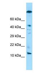 VCY Antibody - VCY antibody Western Blot of Jurkat.  This image was taken for the unconjugated form of this product. Other forms have not been tested.