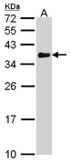 VDAC1 / PORIN Antibody - Sample (30 ug of whole cell lysate). A: A431 . 12% SDS PAGE. VDAC1 antibody. PORIN / VDAC-1 antibody diluted at 1:1000.