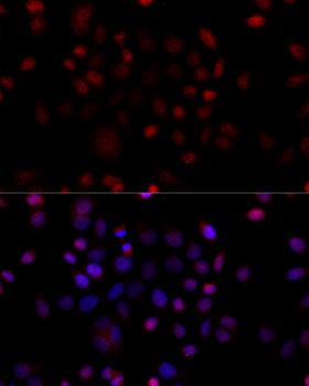 VDAC1 / PORIN Antibody - Immunofluorescence analysis of HeLa cells using VDAC1 antibody at dilution of 1:100 (40x lens). Blue: DAPI for nuclear staining.
