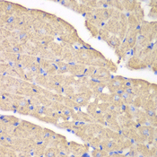 VDAC1 / PORIN Antibody - Immunohistochemistry of paraffin-embedded mouse heart using VDAC1 antibody at dilution of 1:100 (40x lens).