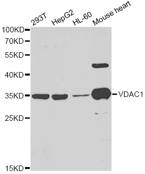VDAC1 / PORIN Antibody - Western blot analysis of extracts of various cell lines, using VDAC1 antibody at 1:1000 dilution. The secondary antibody used was an HRP Goat Anti-Rabbit IgG (H+L) at 1:10000 dilution. Lysates were loaded 25ug per lane and 3% nonfat dry milk in TBST was used for blocking.
