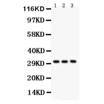 VDAC1 / PORIN Antibody - VDAC antibody Western blot. All lanes: Anti VDAC at 0.5 ug/ml. Lane 1: Rat Liver Tissue Lysate at 50 ug. Lane 2: Mouse Liver Tissue Lysate at 50 ug. Lane 3: SMMC Whole Cell Lysate at 40 ug. Predicted band size: 31 kD. Observed band size: 31 kD.