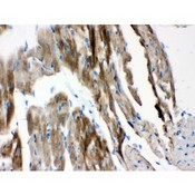 VDAC1 / PORIN Antibody - VDAC antibody IHC-paraffin. IHC(P): Mouse Cardiac Muscle Tissue.