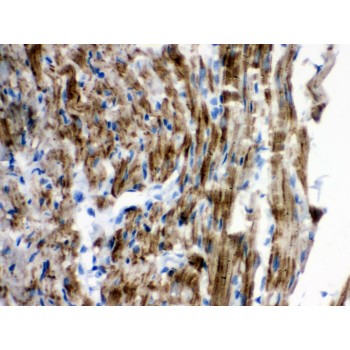 VDAC1 / PORIN Antibody - VDAC antibody IHC-paraffin. IHC(P): Rat Cardiac Muscle Tissue.