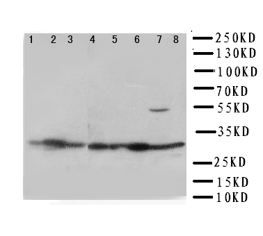 VDAC1 / PORIN Antibody - WB of VDAC1 / PORIN antibody. Lane 1: Rat Skeletal muscle Tissue Lysate. Lane 2: Rat Heart Tissue Lysate. Lane 3: Rat Liver Tissue Lysate. Lane 4: HELA Cell Lysate. Lane 5: A431 Cell Lysate. Lane 6: A549 Cell Lysate. Lane 7: SMMC Cell Lysate. Lane 8: HT1080 Cell Lysate.