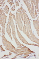 VDAC1 / PORIN Antibody - VDAC1 / PORIN antibody. IHC(P): Rat Cardiac Muscle Tissue.
