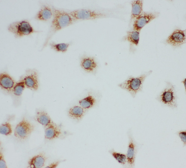 VDAC1 / PORIN Antibody - VDAC1 / PORIN antibody. ICC: NIH3T3 Cell.
