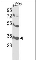 VDAC1 / PORIN Antibody - Western blot of VDAC1 Antibody in HL-60, Y79 cell line lysates (35 ug/lane). VDAC1 (arrow) was detected using the purified antibody.
